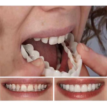 50/100 Kos/veliko Zgornjega & Nižje Zobe, Luske Anti-res 3D Silikonsko Protezo Naramnice za Beljenje Zob Ortodontskega Naramnicami Pokrov