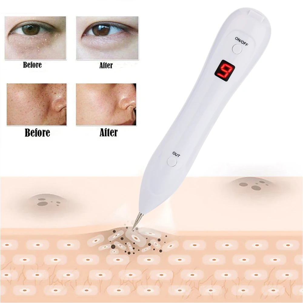 Laser Plazme Pero Mol Odstranitev Temno Spot Remover Nego Kože Točke Pero Kože Wart Oznako Tatoo Orodje za Odstranjevanje Nego Lepote bele slog