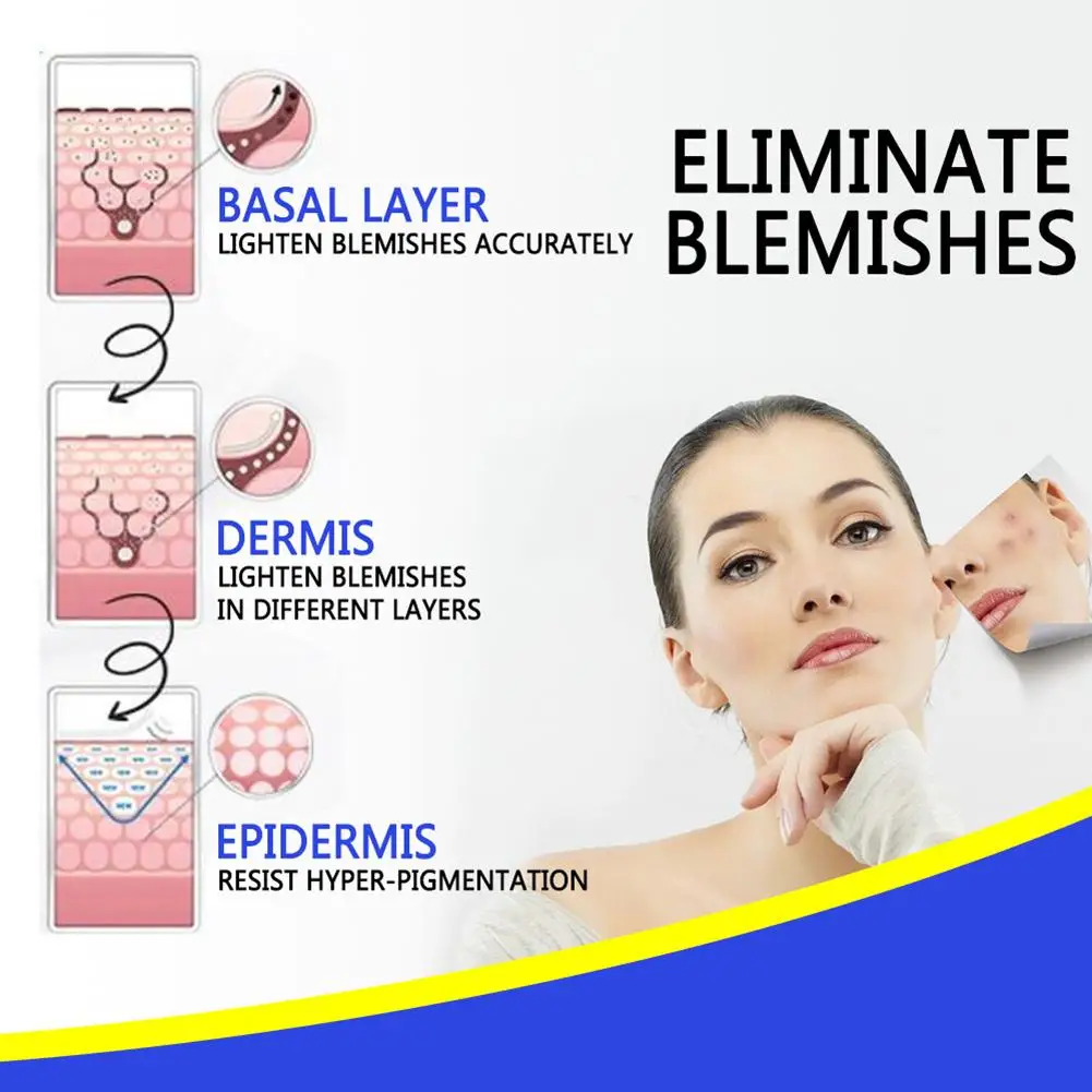 Zdravljenje Aken Blemish Kreme Za Beljenje Kože Vlažilna Krema Akne Odstranjevalec Za Temen Madež Obraz Za Nego Kože, Ki Neguje In Anti Acne Smetane